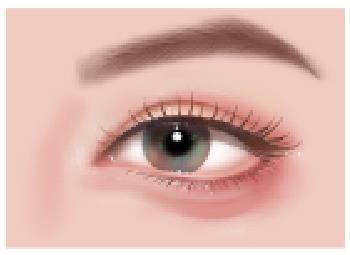 埋线割双眼皮是什么 埋线割双眼皮全过程曝光