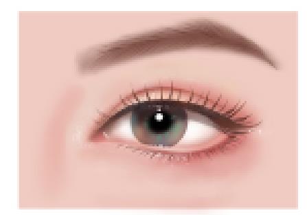 有什么好的方法能去黑眼圈 激光治疗去除黑眼圈会出血嘛